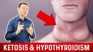 Does Ketosis Cause Hypothyroidism – DrBerg [upl. by Darrelle30]