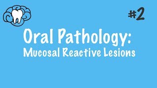 Oral Pathology  Mucosal Reactive Lesions  INBDE ADAT [upl. by Yelra]