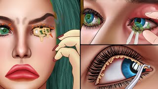 ASMR Clean eyelid inflatmmation Blepharitis animation  Dirty eye treatment [upl. by Bikales]