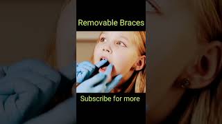 removable braces  braces  shorts dentalasmr trending dental [upl. by Truda]