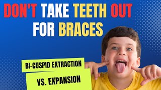 Dont extract teeth with braces  Bicuspid Extraction vs Expansion [upl. by Starr942]