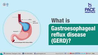 What is Gastroesophageal Reflux Disease GERDDrPhani Krishna Ravula Surgical Gastroenterologist [upl. by Nanoc626]