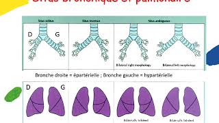 Anatomie du coeur normal et analyse segmentaire Lucile HOUYEL [upl. by Lymn]