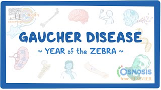 Gaucher disease  NORD Year of the Zebra [upl. by Oona962]