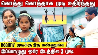 3 வருடமாக முடி கொட்டும் பிரச்சனை அதிகமாக இருந்தது✴️இந்த தப்ப மட்டும் யாரும் பண்ணிறாதீங்க🔥 [upl. by Meridel]