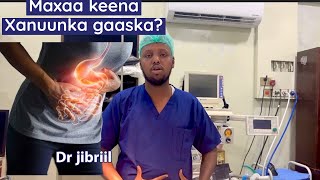 Caalamadaha xanuunka gaastariga  sababa keena xanuunka  Dr jibriil colaad [upl. by Derek32]