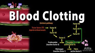 Hemostasis Control of Bleeding Coagulation and Thrombosis Animation [upl. by Thornburg615]