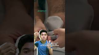 usus dipotong dan bab lewat lubang di perut ini stoma stoma kolostomi setauekida youtubehealth [upl. by Eecart]