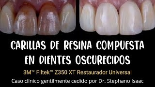 CARILLAS de RESINA COMPUESTA en dientes oscurecidos  Caso Clínico del Dr Stephano Isaac [upl. by Sosanna]