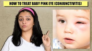 How To Treat Baby Pink Eye Conjunctivitis  Care amp Treatment English [upl. by Ellga]