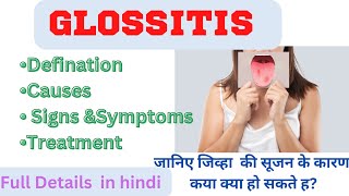 GlossitisDefinition causes signampSymptoms treatment Glossitis full Details tongue disorder [upl. by Leanna685]