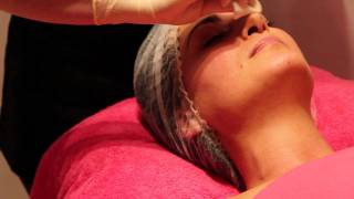 Demonstration of Glycolic Peel at Perfection Skin Clinic [upl. by Haliak]