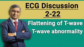 ECG Discussion 222  Flattening of Twave  Twave abnormality  2022 [upl. by Kalli89]