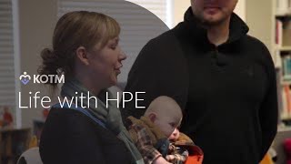 KOTM Parent Stories Holoprosencephaly HPE [upl. by Ativad478]