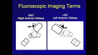 91 Pacemaker Implantation Fluoroscopic Imaging Hong Kong University [upl. by Otreblon93]