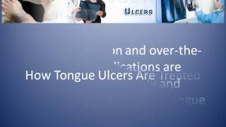 What Causes Ulcers on Tongue and How to Treat It [upl. by Toma]