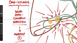 Resumen de la patología de la vía biliar [upl. by Arbe]