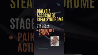 Steal Syndrome  Steal Syndrome in Dialysis  Dialysis Fistula Complication  Stages  Treatment [upl. by Aseela750]