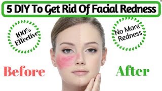 Natural Tips To Get Rid Of Facial Redness  How to Cure Red Irritated Skin  AVNI [upl. by Naitsihc]