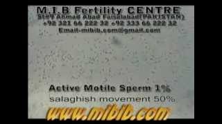 active motile sperm 1 sluggish motile 50 videolow sperm count video [upl. by Hannon]