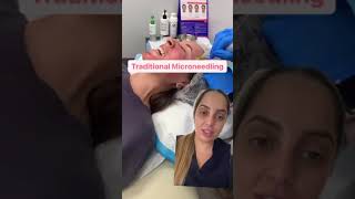 Microneedling vs RF Microneedling Which Skin Treatment Is Right for You [upl. by Zachery]