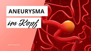 Aneurysma im Kopf Diese Symptome sind Warnzeichen [upl. by Yenolem]