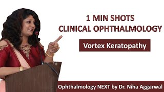 One Min Shots Clinical OphthalmologyVortex Keratopathy  Dr Niha Aggarwal [upl. by Alduino]