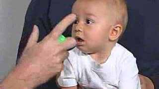 PediatricNeuro Exam 6 month Behavior [upl. by Hillel840]