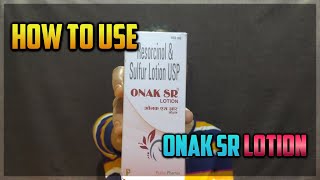 ONAK SR Resorcinolsulfur lotion amp Pretibenzyl 5 lotion BENZYL PEROXIDE review in Hindi [upl. by Hobie]