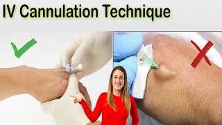 How To Insert IV Cannula  Intravenous Cannulation Techniques [upl. by Burrus685]