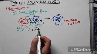 Hypersensitivity type 4 hindi [upl. by Dlopoel704]