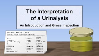 Interpretation of the Urinalysis Part 1  Introduction and Inspection [upl. by Nona]