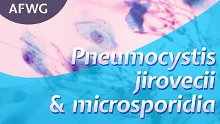 Latest on P jirovecii microsporidia – Prof D Marriott [upl. by Xirtaeb185]