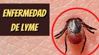 ENFERMEDAD DE LYME síntomas diagnóstico tratamiento y prevención [upl. by Bea]