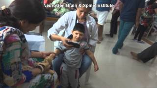 Treatment for Spastic Quadriplegia Cerebral Palsy [upl. by Noram440]