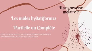 Les môles hydatiformes  grossesse molaire explication Du Dr Bolze [upl. by Ettegdirb]