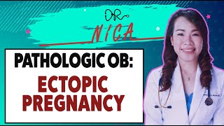 Lectures  Pathologic OB  Ectopic Pregnancy [upl. by Zsolway]