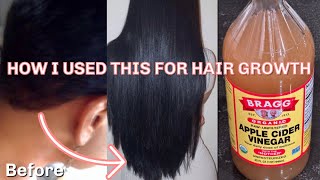 How I Use Apple Cider Vinegar To Grow My Hair Faster  Natural Hair Growth [upl. by Ahael661]