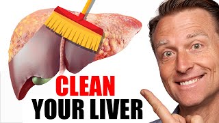 The BEST Foods to Clean Out Your Liver [upl. by Ileane477]