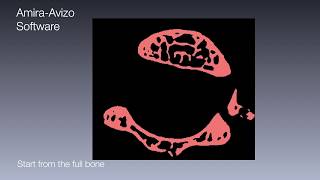 Cortical and trabecular bone segmentation with Amira Software [upl. by Tate]