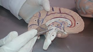 Diencephalon small model  Practical anatomy 2nd year [upl. by Cynarra731]