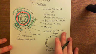 Corticosteroids for Asthma Part 1 [upl. by Gemoets154]