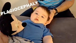 HOW WE FIXED OUR BABYS HEAD WITHOUT A HELMET Plagiocephaly [upl. by Gussi]