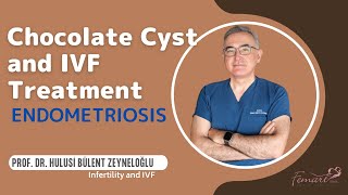 Endometriosis and IVF [upl. by Mcferren112]