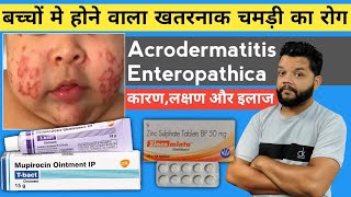 बच्चों का सबसे खतरनाक चर्म रोग 🔥 Acrodermatitis Enteropathica Causes Symptoms amp Treatment [upl. by Wernda]