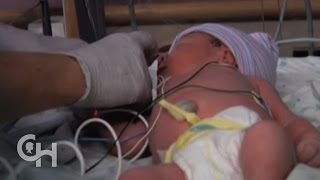 Newborn Care after Spina Bifida Surgery 10 of 12 [upl. by Adnuhs]