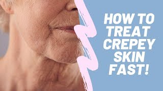 3 Powerful Ways to get rid of Crepey Skin Fast  How to Treat Crepey Skin [upl. by Tada]