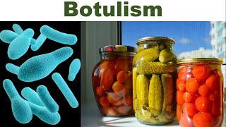 Canned Foods and Botulism What Every Consumer Should Know  Clostridium botulinum  Botulinum Toxin [upl. by Asatan]