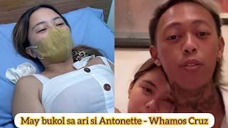 Kasintahan ni Whamos Cruz na si Antonette Gail may bukol sa ri mga netizens nagalala [upl. by Tennek]