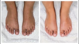 How to do PEDICURE at Home  Summer Ready Feet in Minutes [upl. by Seerdi751]